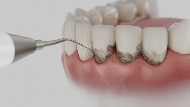 Reliable Dental Implants contractor in Hazel Dell, WA by Smile Center Dentistry